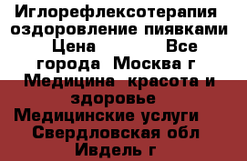 Иглорефлексотерапия, оздоровление пиявками › Цена ­ 3 000 - Все города, Москва г. Медицина, красота и здоровье » Медицинские услуги   . Свердловская обл.,Ивдель г.